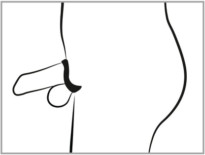 Gabbia Fallica con Dilatatore