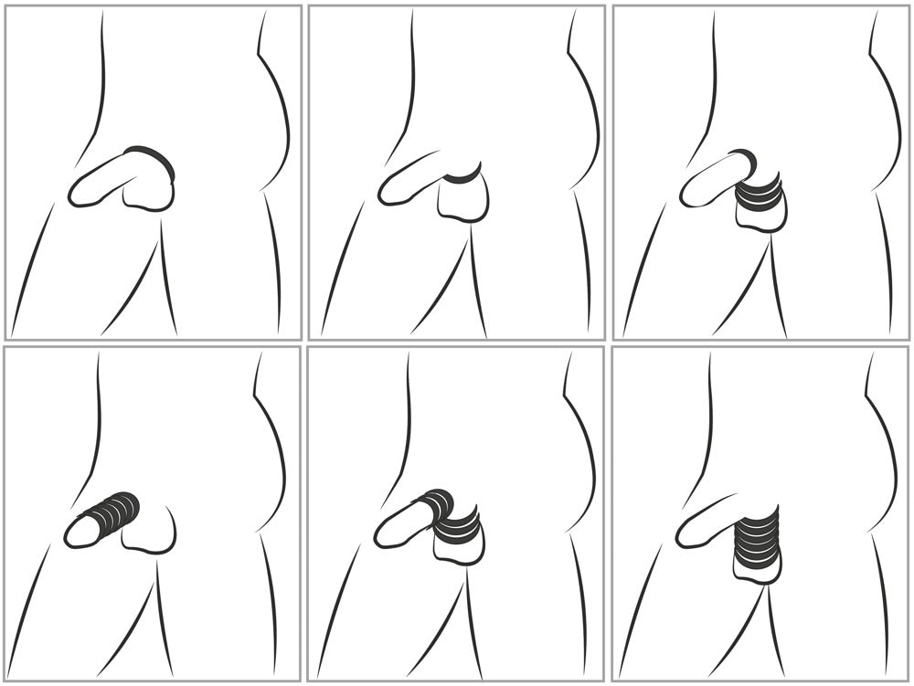 Cock & Ball Stretching Kit